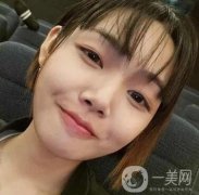 西京整形科價格表收費(fèi)標(biāo)準(zhǔn)多方面一覽！含專家雙眼皮案例術(shù)后照~