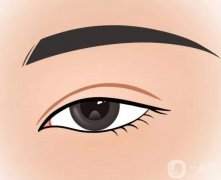 割雙眼皮多少錢?雙眼皮手術(shù)有哪些?