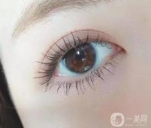 割雙眼皮要多少錢?雙眼皮價(jià)格受哪些因素影響?