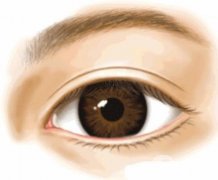 割雙眼皮多少錢?雙眼皮有哪些類型?