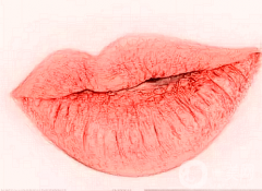 雙美膠原豐唇的副作用!注射膠原蛋白豐唇后的注意事項(xiàng)!