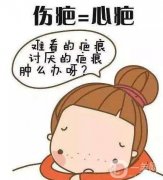 成都疤痕修復醫(yī)院介紹？應該怎么選？