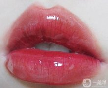 紋唇手術(shù)后多長(zhǎng)時(shí)間結(jié)痂?紋唇前的注意事項(xiàng)有哪些?