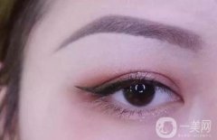 眼角增生可以自行消失嗎?如何預(yù)防開眼角疤痕增生?