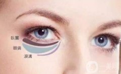 *去眼袋原理是什么?*去眼袋*嗎?