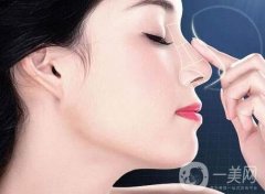 鼻梁可以矯正嗎?鼻梁有點(diǎn)歪是怎么回事?