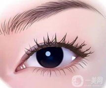 為什么雙眼皮價(jià)格不一樣?雙眼皮手術(shù)后需要注意什么?