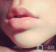 嘴唇外翻矯正多少錢?嘴唇為什么會外翻?