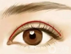 北京雙眼皮手術價格?哪些人不能做割雙眼皮呢?