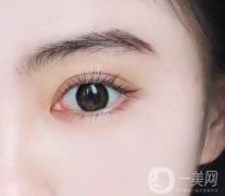 雙眼皮微創(chuàng)多少錢?雙眼皮微創(chuàng)手術有什么優(yōu)勢?