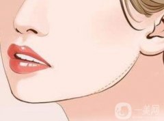 下頜角寬大怎么改良？解決方法！