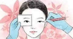 冬季割雙眼皮后如何護(hù)理?