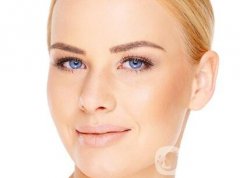 蘋果肌是什么樣的?充填有哪些后遺癥?