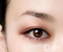 做一次眼部雙眼皮手術(shù)要多少錢?雙眼皮手術(shù)的手術(shù)方式比較?