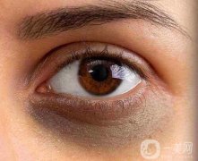 激光去除黑眼圈前后有哪些注意事項(xiàng)?