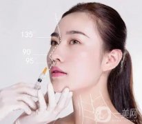 鼻頭縮小如何預(yù)防增生?為什么鼻頭縮小會(huì)增生?