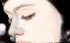 朝天鼻隆鼻用什么假體比較好呢