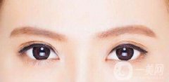 割雙眼皮怎么樣?