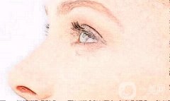 光子嫩膚多長時間可以做一次?