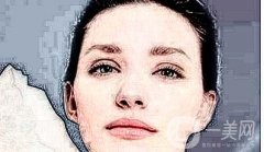 電波拉皮可以去除眼袋嗎?