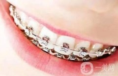 矯正牙齒年齡老了以后牙齒會松動嗎