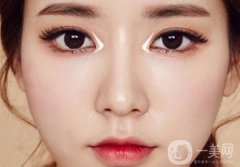 開內(nèi)眼角和外眼角有什么不同?