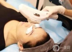 光子嫩膚后有哪些注意事項？生物刺激作用是什么？