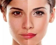 光子嫩膚有什么作用和優(yōu)勢?光子嫩膚讓皮膚變薄是真的嗎?