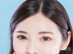 韓式三點雙眼皮優(yōu)缺點是什么？適應哪些人群？