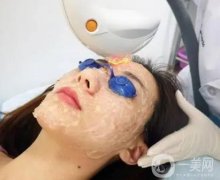 光子嫩膚有沒(méi)有依賴性？美容院的光子嫩膚和醫(yī)院的一樣嗎？
