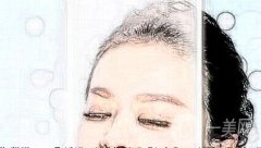 激光祛紅血絲會(huì)不會(huì)復(fù)發(fā)?如何避免復(fù)發(fā)