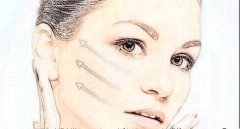 激光去除痘印會(huì)不會(huì)反彈呢?