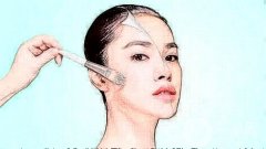 激光去痘印疼嗎，去除痘印后為什么會(huì)留下疤痕?