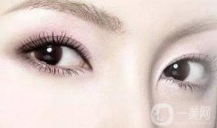 開(kāi)眼角之后會(huì)出現(xiàn)疤痕增生嗎?