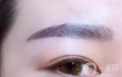 眉毛高低不一能否補(bǔ)救?