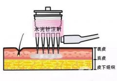 *的作用是什么呢?注意事項(xiàng)有哪些?