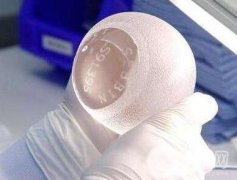 隆胸的危害大嗎?原理是什么?需要注意什么?