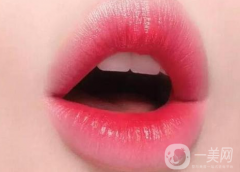 嘴唇外翻整形需要幾次才能成功?