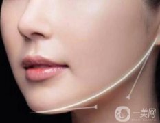 面部吸脂*性的決定因素是什么？*嗎？