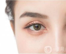 微雕雙眼皮的優(yōu)點(diǎn)及適應(yīng)人群