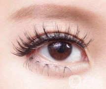 雙眼皮手術(shù)拆線(xiàn)后的注意事項(xiàng)