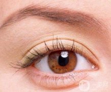 雙眼皮會變回嗎?怎么割雙眼皮有肉條?