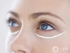 溶脂祛眼袋有什么后遺癥？溶脂祛眼袋適合哪些人？