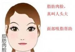 瘦臉整容多少錢?高性價比的整容怎么做?