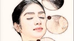 女孩長小胡子怎么辦?