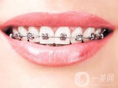 矯正后的牙齒會(huì)反彈嗎?牙齒矯正和反彈有什么關(guān)系?