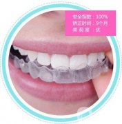 牙齒內(nèi)扣怎么矯正?牙齒內(nèi)扣有哪些矯正方法?