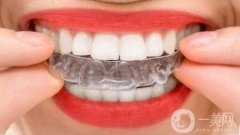 矯正牙齒需要多長(zhǎng)時(shí)間?矯正調(diào)節(jié)時(shí)間長(zhǎng)嗎?