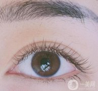 為什么會(huì)有腫泡眼?腫泡眼怎么改良?