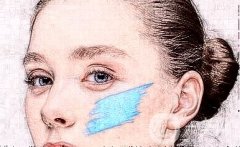 眼皮抽脂是如何抽的呢?